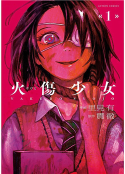 Đọc truyện Yakedo Shoujo (Yakedo Syojo)